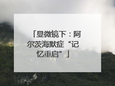 显微镜下：阿尔茨海默症“记忆重启”