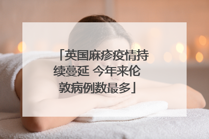 英国麻疹疫情持续蔓延 今年来伦敦病例数最多